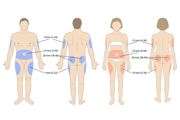 Các vị trí khác tiêm insulin
